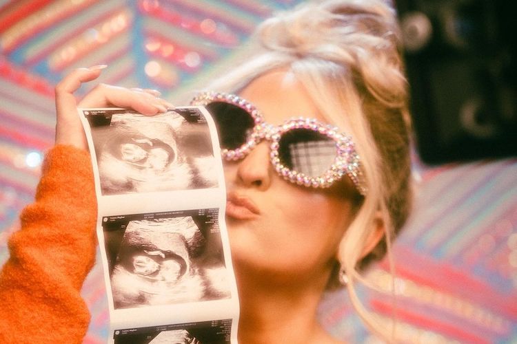 Meghan Trainor's Pregnancy announcement